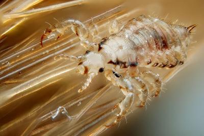 head lice